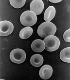 Red blood cells (erythrocytes) are one of the most important constituents of blood