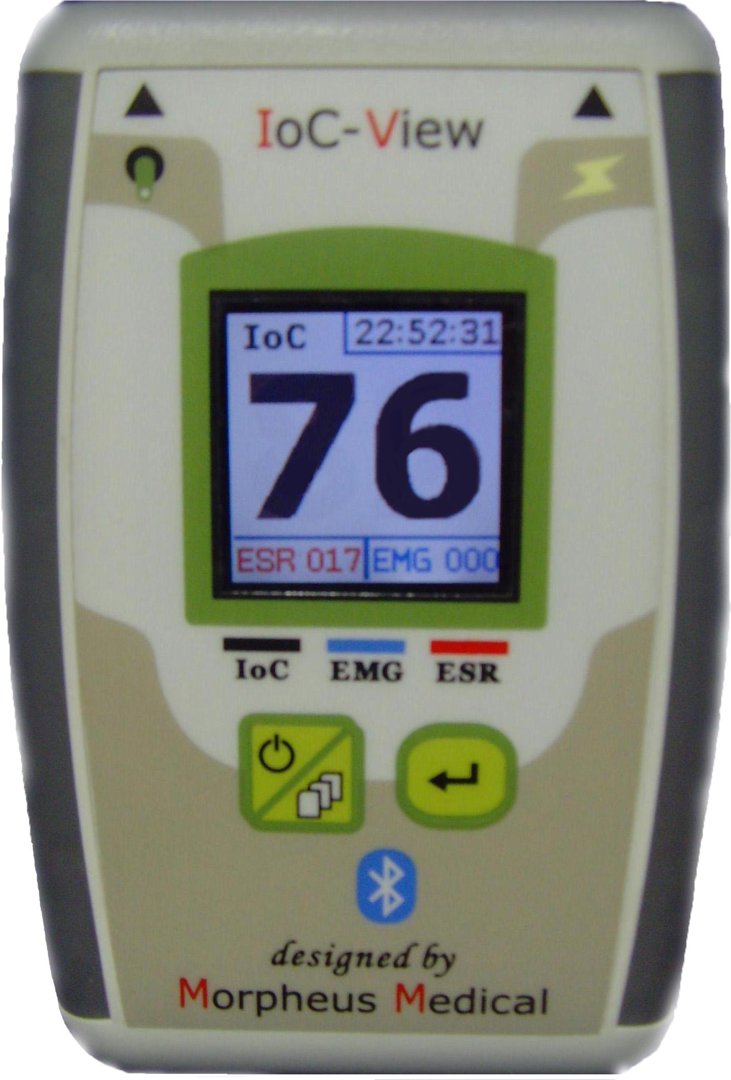 The IoC-view for monitoring the depth of anaesthesia.
