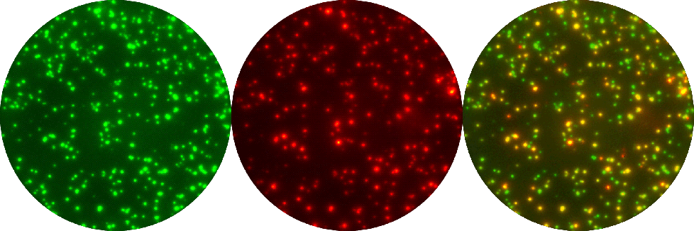 Figure 2. FluoroSpot reader analysis of cells secreting IFN-γ and IL-2. Peripheral blood mononuclear cells (200 000/well) were stimulated for 16 hours with a pool MHC class I-restricted peptides derived from CMV, EBV and Flu virus. Cells secreting both cytokines (about 40% of responding cells) create yellow spots in an overlay of green and red spot images. In the CD8+ T-cell mediated response to CEF, most IL-2 secreting cells also produce IFN-γ. The number of spontaneous spots by unstimulated control cells were <1 in IFN-γ/IL-2 double staining.