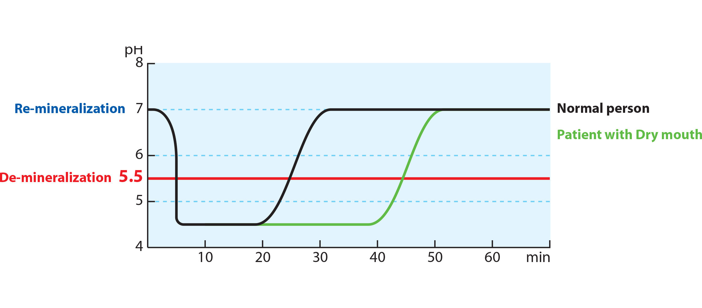Diagram depicting after consuming food high in carbohydrates, the mouth enters an acidic environment within 5 minutes. Under normal conditions of salivation, the acid will be neutralized in about 20 minutes. People with dry mouth often will take twice as long to neutralize mouth acid