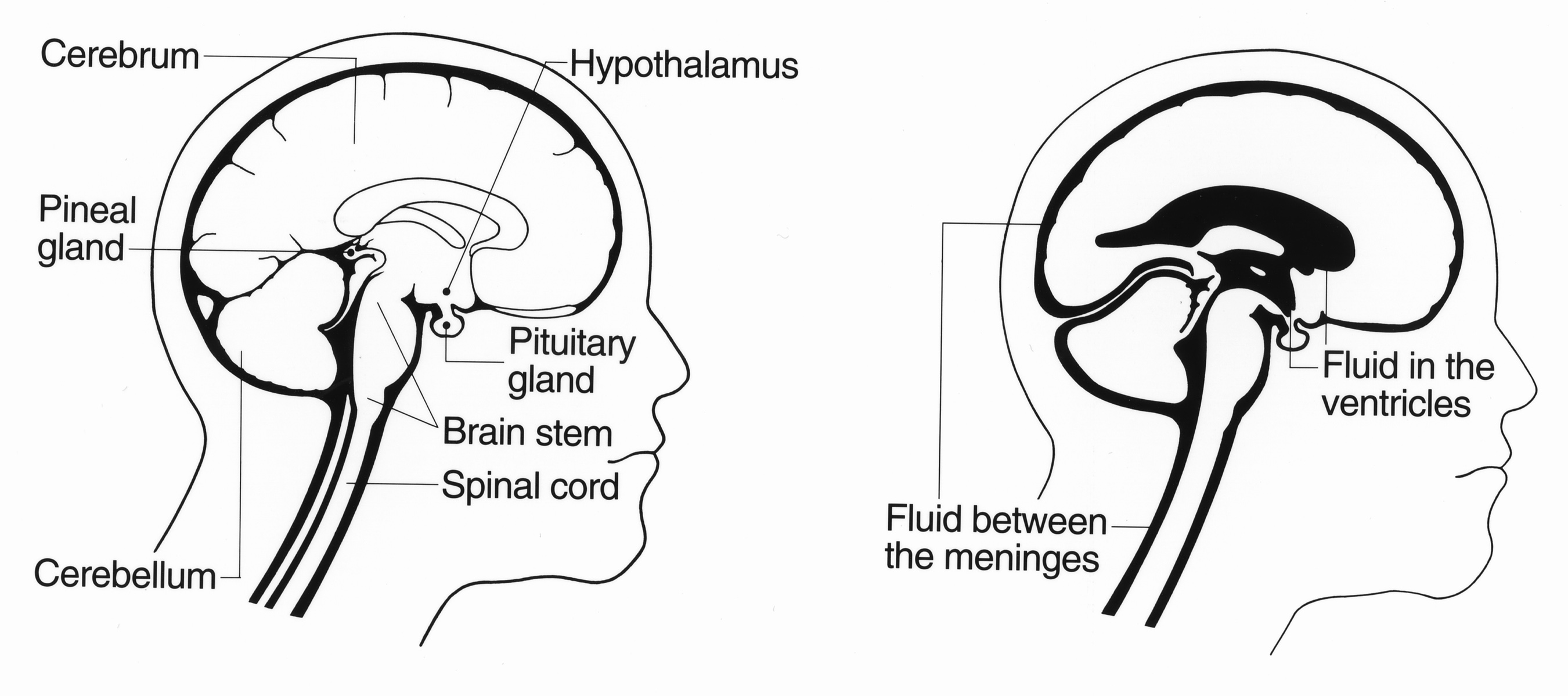 Sections of the Brain