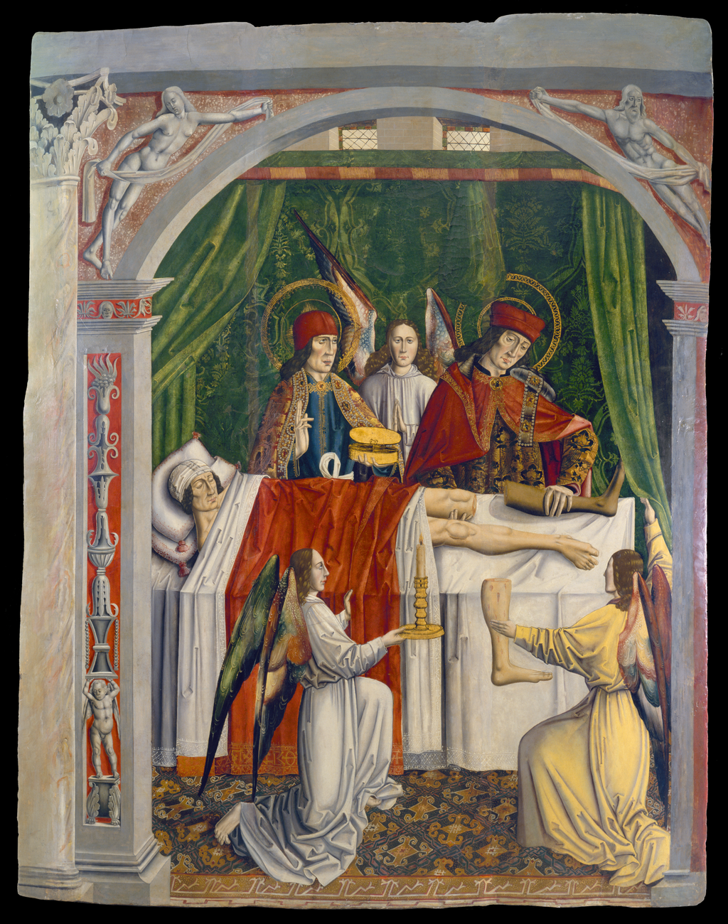 Saints Cosmas and Damian performing a miraculous cure by transplantation of a leg. Oil painting attributed to the Master of Los Balbases, ca. 1495.